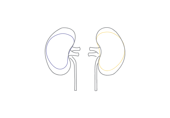 Nephrology